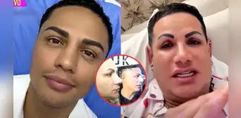 Jonathan Maicelo se somete a nuevos retoques en su rostro y sorprende a gemelo 'Paletazo': "¿Qué es eso, mi amor?" Jonathan Maicelo se somete a nuevos retoques en su rostro y sorprende a gemelo 'Paletazo': "¿Qué es eso, mi amor?"