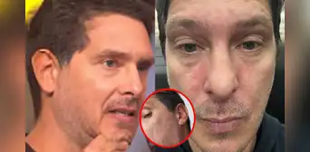 Cristian Rivero revela extraña reacción en su rostro que afecta su salud: “Los nervios existen” Cristian Rivero revela extraña reacción en su rostro que afecta su salud: “Los nervios existen”