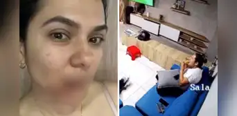 Mujer sufre graves quemaduras en el rostro tras la explosión de una empanada caliente en Medellín, Colombia Mujer sufre graves quemaduras en el rostro tras la explosión de una empanada caliente en Medellín, Colombia