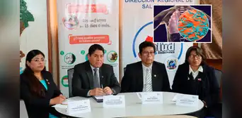 Detectan casi un centenar de casos de tuberculosis en Puno: en el 2024 más de 50 personas fallecieron Detectan casi un centenar de casos de tuberculosis en Puno: en el 2024 más de 50 personas fallecieron