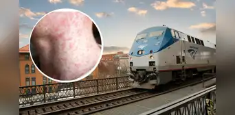 Alerta en Nueva York: reportan que una persona infectada con el virus del sarampión viajó en el tren Amtrak Alerta en Nueva York: reportan que una persona infectada con el virus del sarampión viajó en el tren Amtrak