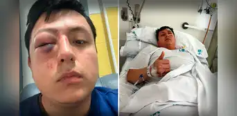 Joven peruano en España casi pierde un ojo tras agresión xenófoba en Madrid: "Nunca me pasó algo como esto"
