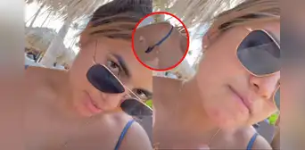Susana Alvarado sufre inesperada reacción en su piel en su viaje con Paco Bazán al Caribe: "Todo mal"