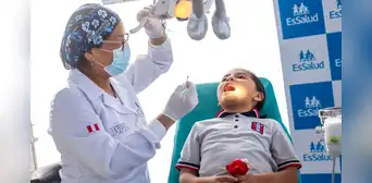 Especialistas de Essalud advierten que 9 de cada 10 niños tienen caries dental
