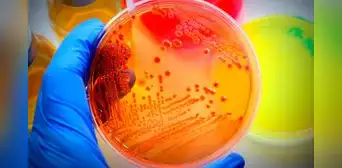 Alerta sanitaria en Florida: la bacteria que podría entrar a tu cuerpo, si no hierves el agua, según autoridades municipales Alerta sanitaria en Florida: la bacteria que podría entrar a tu cuerpo, si no hierves el agua, según autoridades municipales