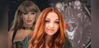 Fue al hospital por olvidar canción de Taylor Swift y descubre enfermedad cerebral que médicos ignoraron por un mes: "Dijeron que era normal" Fue al hospital por olvidar canción de Taylor Swift y descubre enfermedad cerebral que médicos ignoraron por un mes: "Dijeron que era normal"