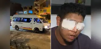 Chofer de 'La Colonial' podría quedar ciego tras ser baleado por extorsionadores que exigían el pago de cinco soles diarios Chofer de 'La Colonial' podría quedar ciego tras ser baleado por extorsionadores que exigían el pago de cinco soles diarios