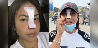 Dayanita explica por qué se operó la nariz tras polémica por quemar cráneo humano: "No podía respirar bien"