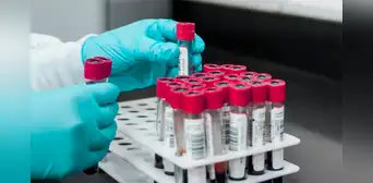 Escándalo en Reino Unido: 400.000 personas expuestas a hepatitis por transfusiones de sangre contaminada
