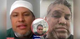 Ingeniero peruano denuncia agresión xenófoba en Chile y paramédicos se niegan a atenderlo a tiempo: "Me dijeron que no podían intervenir" Ingeniero peruano denuncia agresión xenófoba en Chile y paramédicos se niegan a atenderlo a tiempo: "Me dijeron que no podían intervenir"