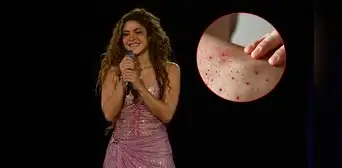 Nueva Jersey lanza alerta sanitaria tras un posible contagio masivo de sarampión en concierto de Shakira Nueva Jersey lanza alerta sanitaria tras un posible contagio masivo de sarampión en concierto de Shakira