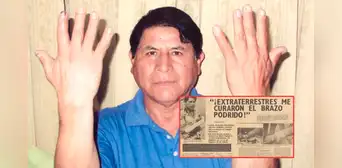 El curioso caso de Donato Cervantes, el peruano que iba a ser amputado del brazo, pero afirmó haber sido curado por extraterrestres El curioso caso de Donato Cervantes, el peruano que iba a ser amputado del brazo, pero afirmó haber sido curado por extraterrestres