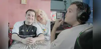 Superó leucemia, una infección que afecto su cara y 30 cirugías: la historia de superación de un adolescente que estuvo al borde de la muerte en Argentina