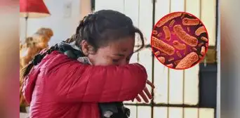 ¿Qué es la tos ferina, cuáles son sus síntomas y cómo prevenir el contagio?