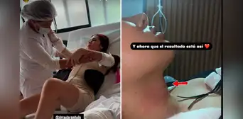 La ‘Uchulú’ impacta con radical cambio tras cirugía para reducirse ‘la manzana de Adán’ y costillas: “Pienso hacerme la voz en Colombia” La ‘Uchulú’ impacta con radical cambio tras cirugía para reducirse ‘la manzana de Adán’ y costillas: “Pienso hacerme la voz en Colombia”