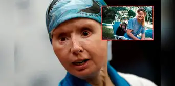 El impactante caso de Charla Nash, la mujer que fue atacada por un chimpancé que le desfiguró el rostro: arrancó labios, nariz y párpados El impactante caso de Charla Nash, la mujer que fue atacada por un chimpancé que le desfiguró el rostro: arrancó labios, nariz y párpados