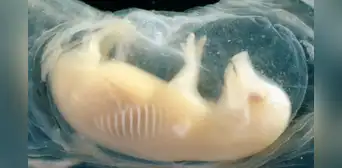 Científicos de China crean corazones con células humanas en embriones de cerdo: un avance clave para los futuros trasplantes Científicos de China crean corazones con células humanas en embriones de cerdo: un avance clave para los futuros trasplantes