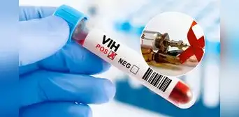 Así es la inyección que previene el VIH, el mayor avance contra el sida, según médico infectólogo peruano Así es la inyección que previene el VIH, el mayor avance contra el sida, según médico infectólogo peruano
