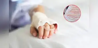 Extraen 142 lombrices intestinales a niño en México: lo operaron de emergencia tras dos días de dolores abdominales