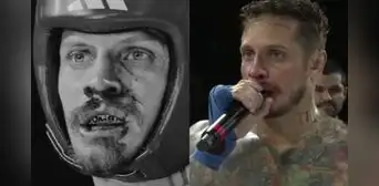 Así quedó el rostro de Nico Ponce tras la fuerte paliza de Jenko del Río en 'Celebrity Combat Perú 2' Así quedó el rostro de Nico Ponce tras la fuerte paliza de Jenko del Río en 'Celebrity Combat Perú 2'