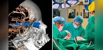 Salvan de morir a niño de 3 años que quedó con un metal incrustado en su cabeza, en San Borja Salvan de morir a niño de 3 años que quedó con un metal incrustado en su cabeza, en San Borja