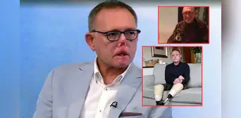 El trágico caso de Jaco Nel, el hombre que perdió piernas, dedos y parte de su cara por lamida y arañazo de su perro
