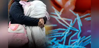 Más de 400 recién nacidos mueren al año por virus sincitial respiratorio y Minsa no aplica vacuna Más de 400 recién nacidos mueren al año por virus sincitial respiratorio y Minsa no aplica vacuna