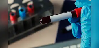 "Solo hay una": científicos descubren un nuevo tipo de sangre, pero le pertenece a una "única persona en el mundo" "Solo hay una": científicos descubren un nuevo tipo de sangre, pero le pertenece a una "única persona en el mundo"