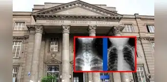 Anciana de 89 años se salva de morir tras tragar un anillo: médicos del Hospital Loayza lo extrajeron sin cirugía Anciana de 89 años se salva de morir tras tragar un anillo: médicos del Hospital Loayza lo extrajeron sin cirugía