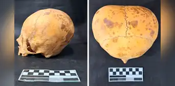 Arqueólogos resuelven el misterio de un cráneo con presunto aspecto ‘alienígena’ encontrado en Sudamérica