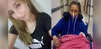 Fue a ligarse las trompas y terminó perdiendo una pierna y su corazón: el impactante caso de Alison Calfunao en Argentina Fue a ligarse las trompas y terminó perdiendo una pierna y su corazón: el impactante caso de Alison Calfunao en Argentina