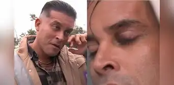 Christian Domínguez sorprende al reaparecer con el ojo morado tras ausentarse de su programa: “Jugué muy fuerte”