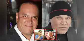 Mauricio Diez Canseco luce radical cambio facial tras someterse a retoques estéticos y Magaly reacciona: "Es otro"