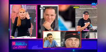 Mauricio Diez Canseco reaparece con radical cambio de rostro, pero cirujanos advierten: “No se lo hubiera realizado”