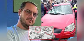 Youtuber 'Furrey' se encuentra con respiración mecánica y continúa en UCI, según su abogado: “No está estable” Youtuber 'Furrey' se encuentra con respiración mecánica y continúa en UCI, según su abogado: “No está estable”