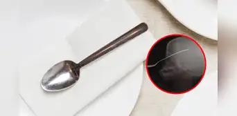 Niña sufre terrible accidente tras caer mientras corría con una cuchara en la mano en Venezuela: su estado es crítico Niña sufre terrible accidente tras caer mientras corría con una cuchara en la mano en Venezuela: su estado es crítico