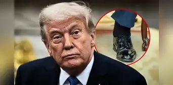 ¿Qué es la insuficiencia venosa crónica que afecta a Donald Trump y por qué es tan común en personas mayores con sobrepeso?