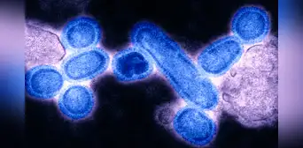 Científicos resucitaron el virus de la “gripe española” de hace casi 100 años y descubren algo aterrador: ya había mutado para evadir nuestros cuerpos Científicos resucitaron el virus de la “gripe española” de hace casi 100 años y descubren algo aterrador: ya había mutado para evadir nuestros cuerpos