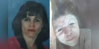 El trágico caso de una mujer que creyó que le inyectaban vitamina C y terminó siendo una sustancia prohibida: "Acabó con mi rostro" El trágico caso de una mujer que creyó que le inyectaban vitamina C y terminó siendo una sustancia prohibida: "Acabó con mi rostro"