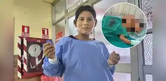 Iquitos: niña de 4 años con graves quemaduras al caerle olla de caldo hirviendo
