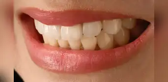 Científicos en Inglaterra descubren un nuevo tratamiento que permite regenerar naturalmente los dientes en adultos Científicos en Inglaterra descubren un nuevo tratamiento que permite regenerar naturalmente los dientes en adultos