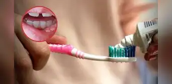 Especialista en Odontología Biomimética revela la verdad sobre el fluoruro de estaño, alertado por Digemid como riesgoso: "Hubo una mala comunicación" Especialista en Odontología Biomimética revela la verdad sobre el fluoruro de estaño, alertado por Digemid como riesgoso: "Hubo una mala comunicación"