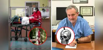Adulto mayor sobrevivió dos días con una flecha clavada en la cabeza y llegó consciente al hospital en Italia Adulto mayor sobrevivió dos días con una flecha clavada en la cabeza y llegó consciente al hospital en Italia