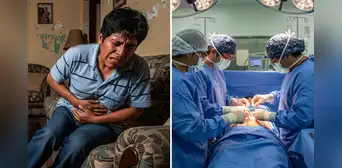 ¿Por qué los peruanos dicen que el apéndice no sirve? Especialista explica el motivo para extraer este órgano y cómo es la operación ¿Por qué los peruanos dicen que el apéndice no sirve? Especialista explica el motivo para extraer este órgano y cómo es la operación