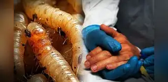 Detectan el primer caso humano del parásito del gusano come carne en EEUU, asociado a un viaje de El Salvador