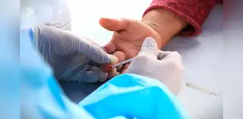 ¿Cómo reconocer si tengo sífilis? La enfermedad que sí tiene cura si se detecta a tiempo, según Minsa ¿Cómo reconocer si tengo sífilis? La enfermedad que sí tiene cura si se detecta a tiempo, según Minsa