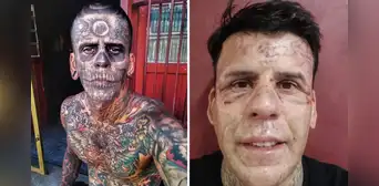 Su cuerpo estaba cubierto de tatuajes y ahora luce irreconocible tras someterse a una cirugía láser para quitárselos: conoce la historia de Leandro de Souza Su cuerpo estaba cubierto de tatuajes y ahora luce irreconocible tras someterse a una cirugía láser para quitárselos: conoce la historia de Leandro de Souza