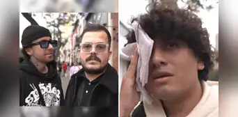 Youtuber Roberto Artigas y su equipo fueron agredidos por sujeto en Miraflores: camarógrafo terminó con un corte en la ceja Youtuber Roberto Artigas y su equipo fueron agredidos por sujeto en Miraflores: camarógrafo terminó con un corte en la ceja