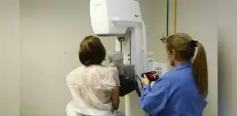 7 de cada 10 casos de cáncer de mama se detectan tarde 7 de cada 10 casos de cáncer de mama se detectan tarde