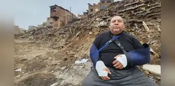 Hombre se fractura ambas muñecas al salvar a su perro y gato de incendio en Pamplona Alta: "Solo pude tirarme" Hombre se fractura ambas muñecas al salvar a su perro y gato de incendio en Pamplona Alta: "Solo pude tirarme"